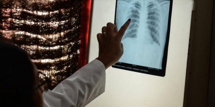 ಕೋವಿಡ್ -19 ಸಾಂಕ್ರಾಮಿಕ ರೋಗದ ವಿರುದ್ಧ ಭಾರತದ ಹೋರಾಟದಲ್ಲಿ ಅವಗಣನೆಗೆ ಒಳಗಾಯಿತೇ ಟಿ.ಬಿ?