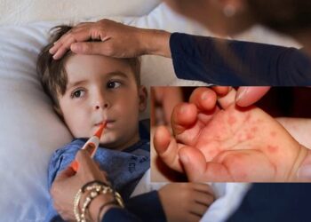 ಕೇರಳದಲ್ಲಿ ಪತ್ತೆಯಾದ ಟೊಮೇಟೋ ಜ್ವರ : ಯಾರಿಗೆ ತಗುಲುತ್ತದೆ? ಏನಿದರ ಗುಣ ಲಕ್ಷಣ?