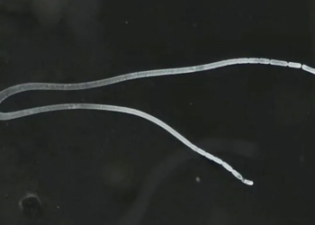 ಜಗತ್ತಿನಲ್ಲೇ ಅತಿ ದೊಡ್ಡ ಬ್ಯಾಕ್ಟಿರಿಯಾ ಪತ್ತೆ: ಬರಿಕಣ್ಣಿಗೂ ಕಾಣುತ್ತೆ!