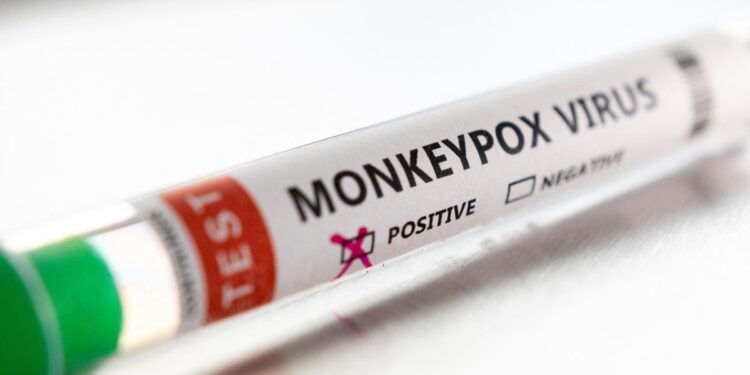 ಮಂಕಿಪಾಕ್ಸ್ ಲಸಿಕೆ ಅಭಿವೃದ್ಧಿಪಡಿಸಲು ಟೆಂಡರ್ ಕರೆದ ಕೇಂದ್ರ ಸರ್ಕಾರ