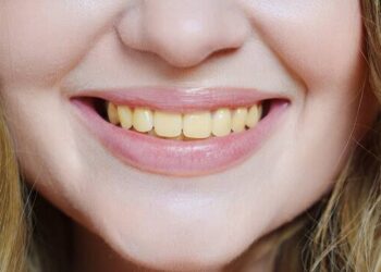 Yellow teeth: ಹಳದಿ ಹಲ್ಲುಗಳು ಬಿಳಿಯಾಗ್ಬೇಕಾ?ಈ ಮನೆ ಮದ್ದನ್ನು ಬಳಸಿ.!