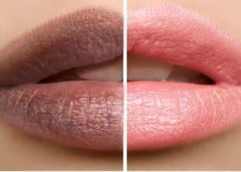 Lip care: ನಿಮ್ಮ ತುಟಿಗಳು ಕಪ್ಪಾಗಿದ್ಯಾ,ಹಾಗಿದ್ರೆ ಈ ಸಿಂಪಲ್ ಹ್ಯಾಕ್ ನ ಟ್ರೈ ಮಾಡಿ.!