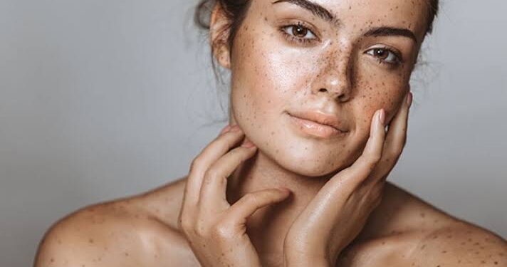 Pigmentation: ಮುಖದ ಮೇಲೆ ಬಂಗು ಬಂದ್ರೆ, ಈ ಮನೆ ಮದ್ದುಗಳನ್ನು ಬಳಸಿ.!