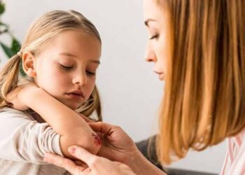 ಗಾಯದ ಗುರುತನ್ನ ಶಮನ ಮಾಡುವುದಕ್ಕೆ ಈ ಮನೆಮದ್ದನ್ನು ಬಳಸಿ.!