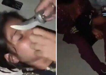 ಪ್ರಸ್ತಾಪವನ್ನು ನಿರಾಕರಿಸಿದ ಪುರುಷರು ಮಹಿಳೆಯ ಕಾಲುಗಳನ್ನು ಕಟ್ಟಿ ಮೂಗನ್ನು ಕತ್ತರಿಸಿದ್ದಾರೆ