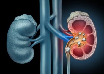 Kidney stone: ಕಿಡ್ನಿ ಸ್ಟೋನ್ ಸಮಸ್ಯೆಗೆ ಪ್ರಮುಖ ಕಾರಣಗಳೇನು ಗೊತ್ತಾ.?