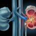 Kidney stone: ಕಿಡ್ನಿ ಸ್ಟೋನ್ ಸಮಸ್ಯೆಗೆ ಪ್ರಮುಖ ಕಾರಣಗಳೇನು ಗೊತ್ತಾ.?