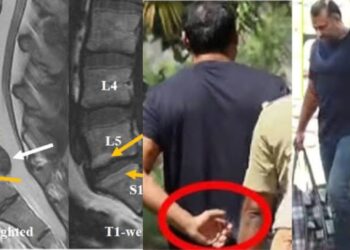 ದರ್ಶನ್ ಗೆ L5,S1 ನಲ್ಲಿ ಗಂಭೀರ ಸಮಸ್ಯೆ – ಸರ್ಜರಿ ಮಾಡದಿದ್ರೆ ಅಪಾಯ ಎಂದ ವೈದ್ಯರು !