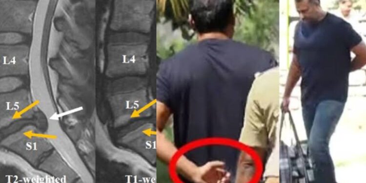 ದರ್ಶನ್ ಗೆ L5,S1 ನಲ್ಲಿ ಗಂಭೀರ ಸಮಸ್ಯೆ – ಸರ್ಜರಿ ಮಾಡದಿದ್ರೆ ಅಪಾಯ ಎಂದ ವೈದ್ಯರು !