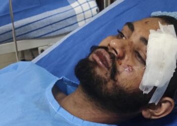 ಬೆಂಗಳೂರನ್ನು ನೋಡಲು ಬಂದ ಯುವಕ ರೈಲ್ವೆ ಅಪಘಾತಕ್ಕೆ ತುತ್ತು – ಗಂಭೀರ ಗಾಯ ! 