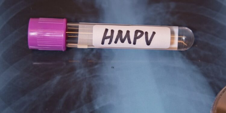 BREAKING : ಬೆಂಗಳೂರಿನಲ್ಲಿ ಮೊದಲ HMPV ವೈರಸ್ ಪ್ರಕರಣ ಪತ್ತೆ ! 8 ತಿಂಗಳ ಮಗುವಿನಲ್ಲಿ ಪತ್ತೆಯಾದ ಸೋಂಕು