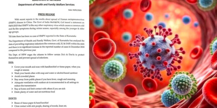 HMPV ಬಗ್ಗೆ ಆತಂಕ ಪಡಬೇಡಿ – ತಪ್ಪದೇ ಈ ಕ್ರಮಗಳನ್ನು ಅನುಸರಿಸಿ ! ರಾಜ್ಯ ಆರೋಗ್ಯ ಇಲಾಖೆಯ ಪ್ರಕಟಣೆ ! 