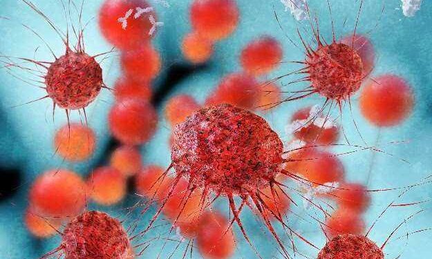 ಪುಣೆಯಲ್ಲಿ ಗಿಲ್ಲಿಯನ್-ಬಾರೆ ಸಿಂಡ್ರೋಮ್ (GBS) ರೋಗಿಗಳ ಮಾದರಿಗಳಲ್ಲಿ ನೊರೋವೈರಸ್ ಮತ್ತು ಬ್ಯಾಕ್ಟೀರಿಯಾ ಪತ್ತೆ