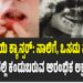 ಬಾಯಿ ಕ್ಯಾನ್ಸರ್: ನಾಲಿಗೆ, ಒಸಡು ಮತ್ತು ಗಂಟಲಿನಲ್ಲಿ ಕಂಡುಬರುವ ಆರಂಭಿಕ ಲಕ್ಷಣಗಳಿವು!