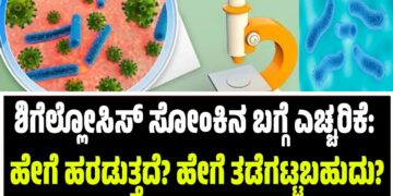 ಶಿಗೆಲ್ಲೋಸಿಸ್ ಸೋಂಕಿನ ಬಗ್ಗೆ ಎಚ್ಚರಿಕೆ: ಹೇಗೆ ಹರಡುತ್ತದೆ? ಹೇಗೆ ತಡೆಗಟ್ಟಬಹುದು?